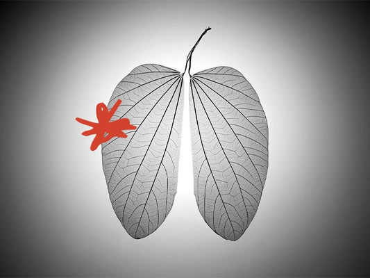 Why many people with lung cancer who have never smoked don't respond well to treatments