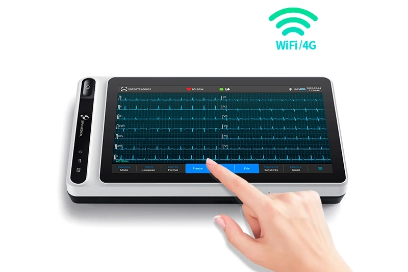 Tablet ECG Machine S120 Smart Portable 12-Lead Cardiac Monitor with Bluetooth Printer Artificial Intelligence Analysis Diagnosis and Touch Screen