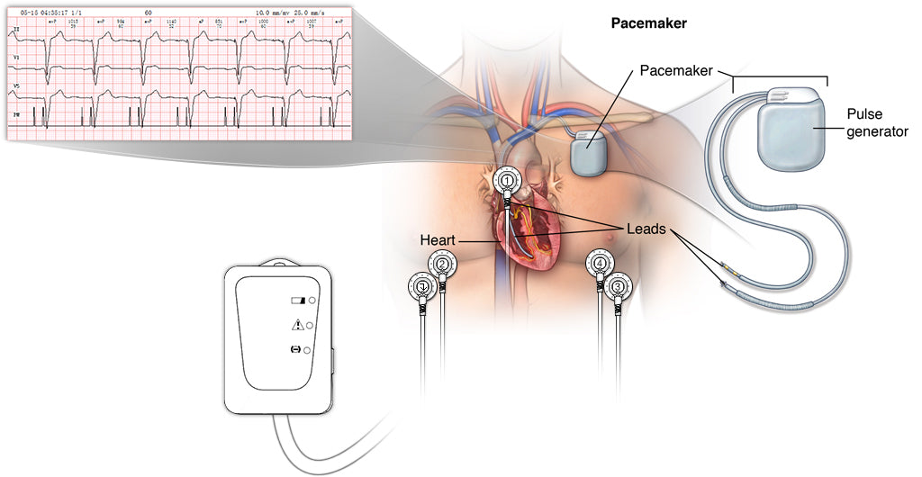 3-channels all-in-one 48 hours of continuous ECG