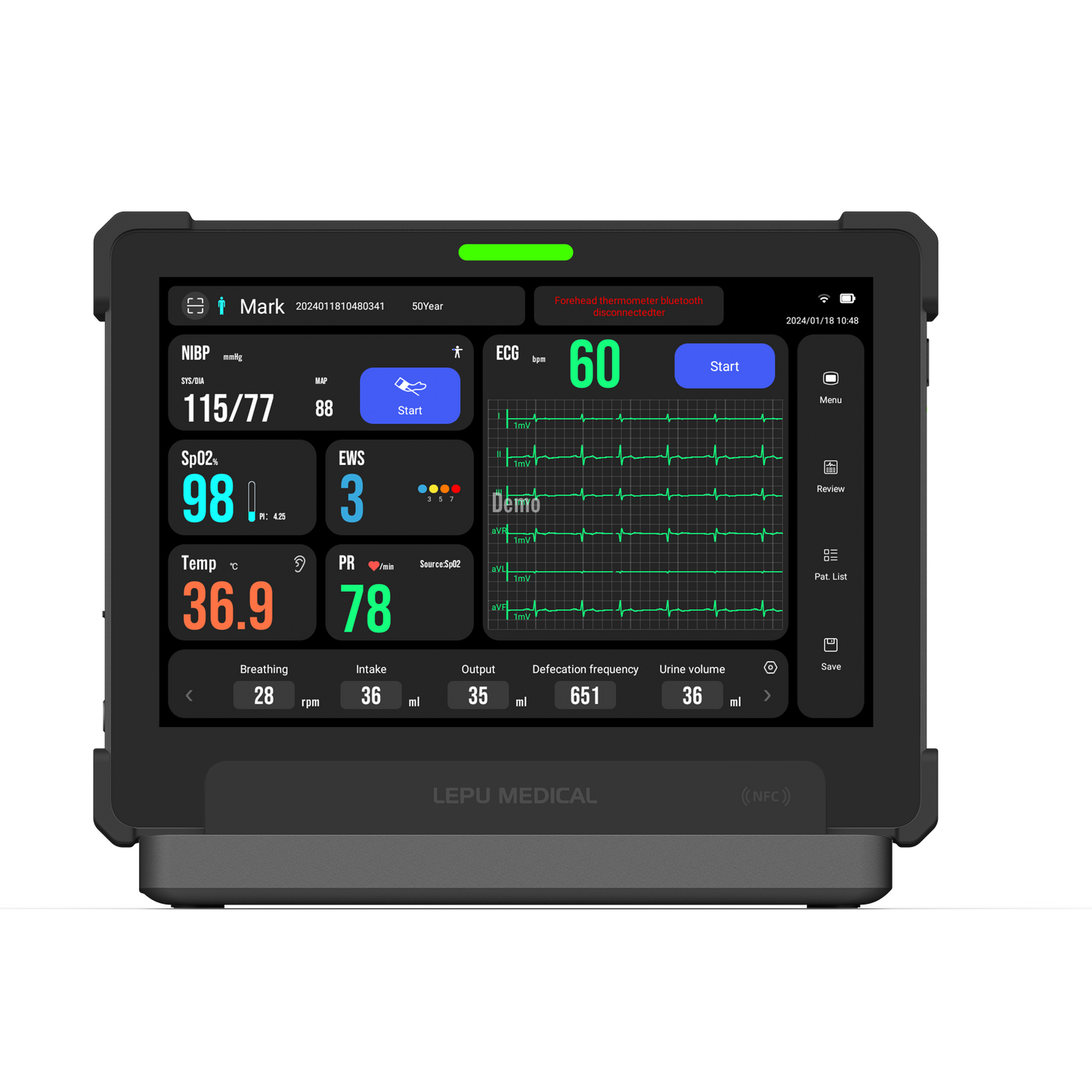 AI Remote Monitoring Device Multi Parameter Telemedicine Vital Signs Monitor