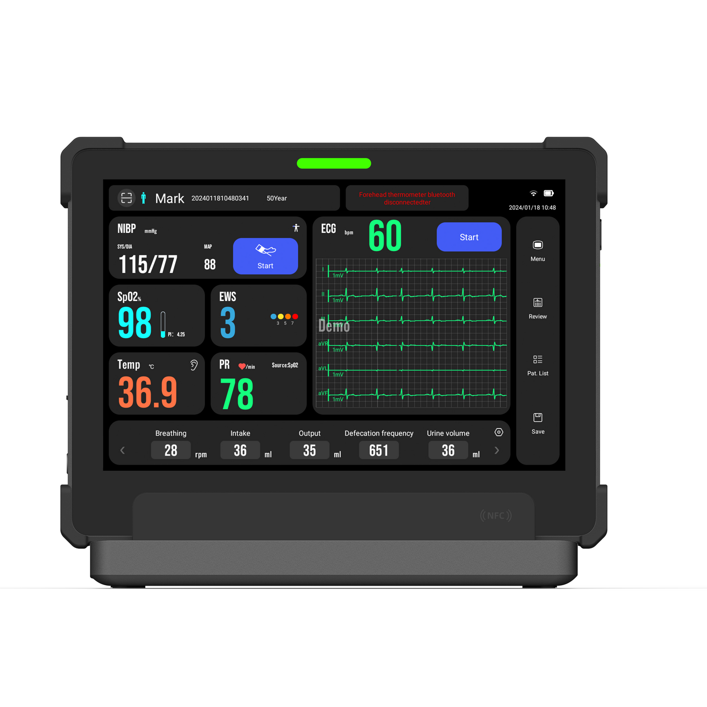 Standard Multi-Parameters Portable Vital Sians Monitor Medical Telemedicine Equipment