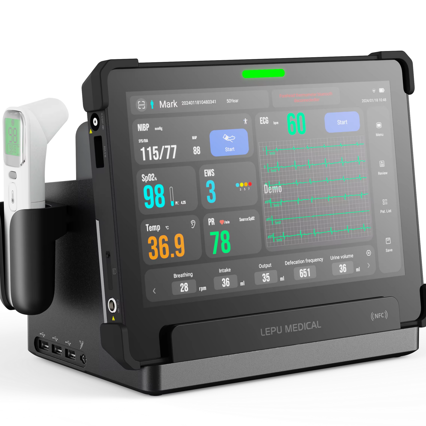 AI Remote Monitoring Device Multi Parameter Telemedicine Vital Signs Monitor