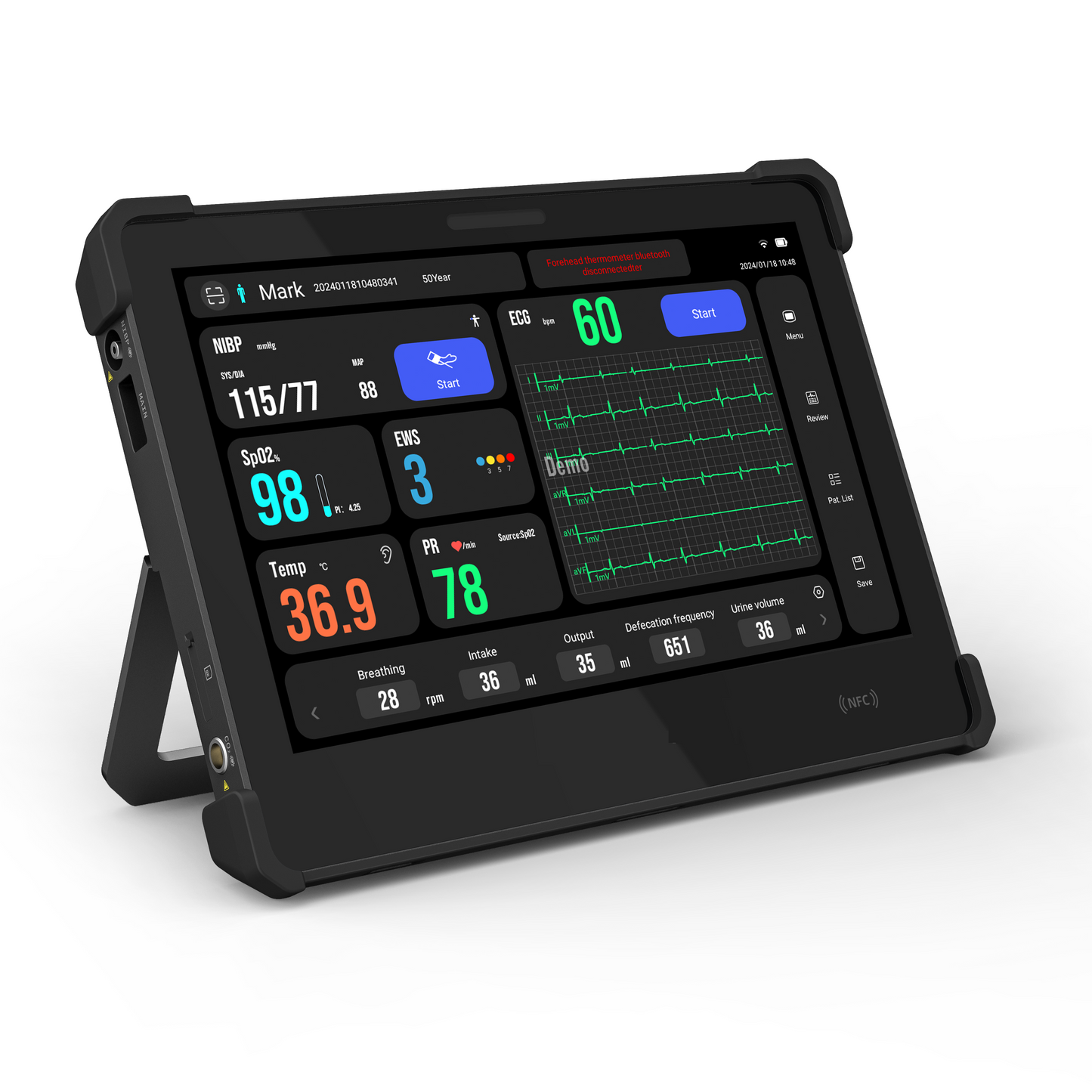 Standard Multi-Parameters Portable Vital Sians Monitor Medical Telemedicine Equipment
