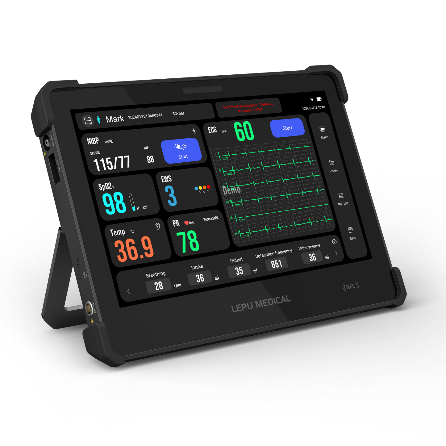 AI Remote Monitoring Device Multi Parameter Telemedicine Vital Signs Monitor