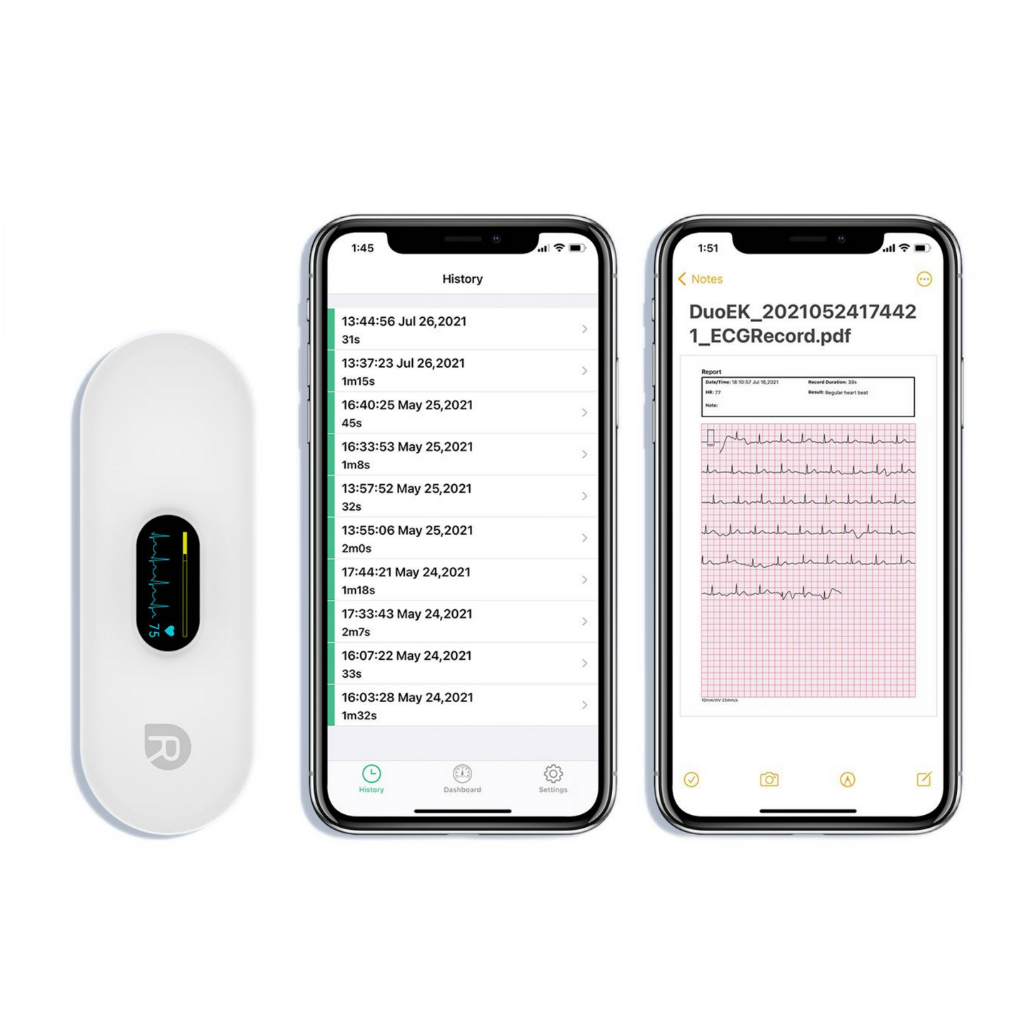 72 Hours Real-time ECG Monitoring ECG Recorder ER2