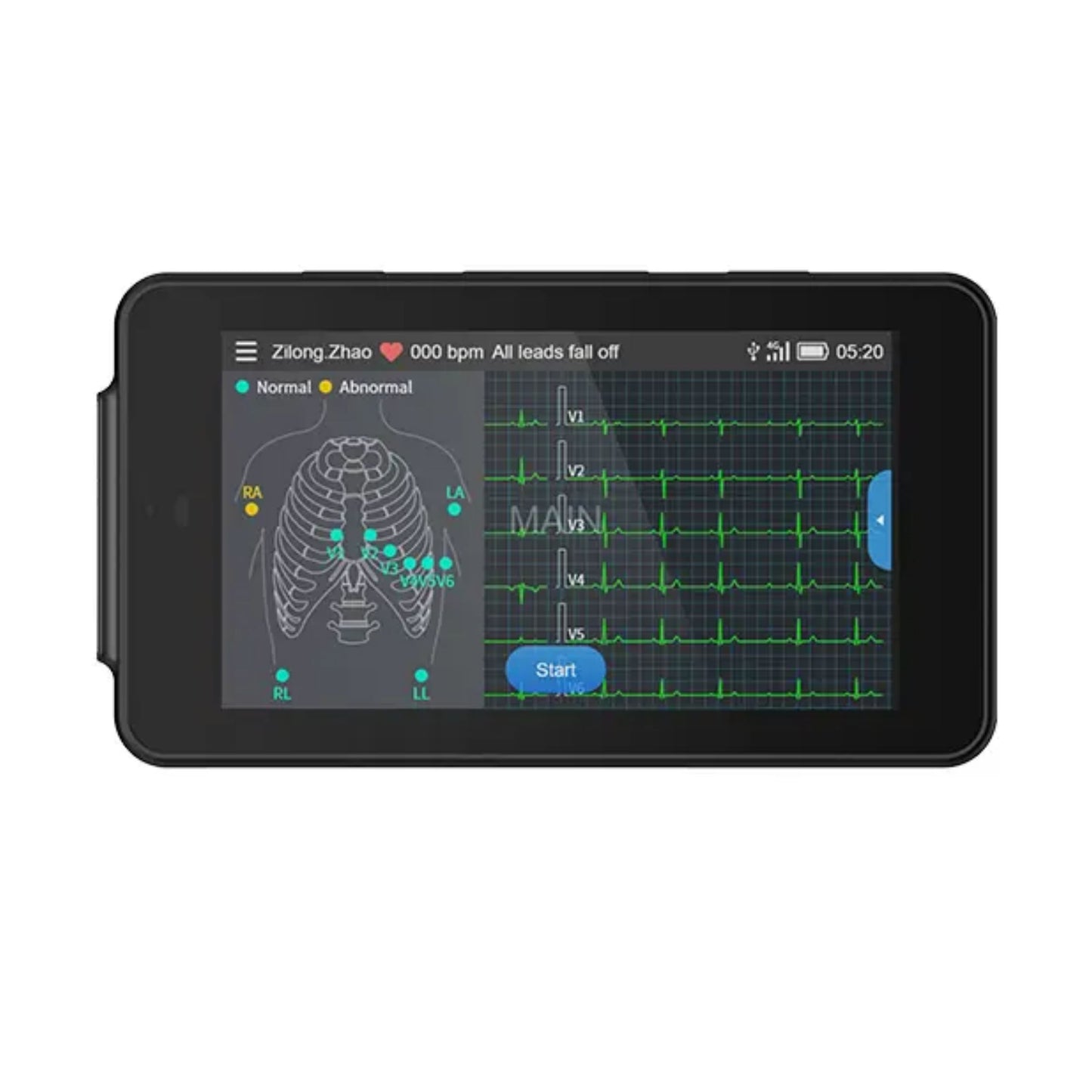 12 channel ECG Holter Up to 8 days cable heart rate monitor ecg monitor holter ecg