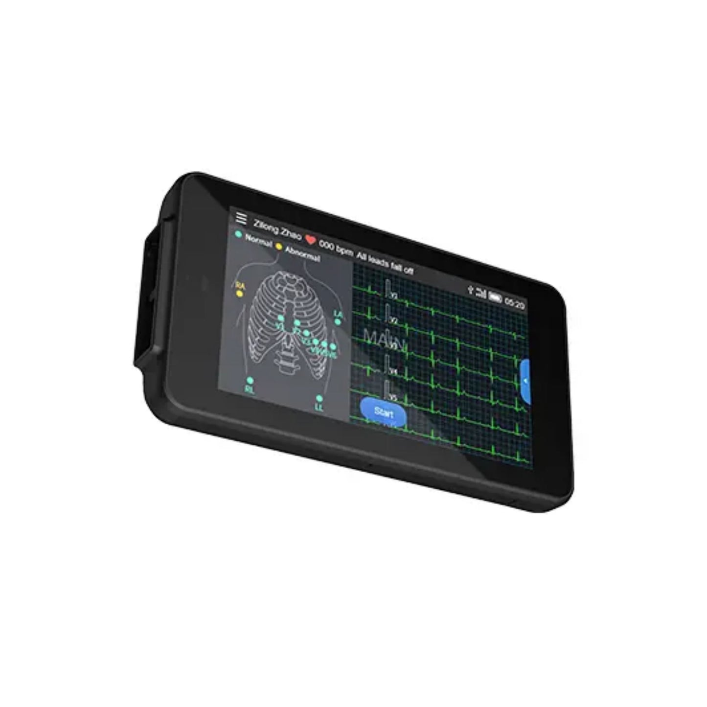 12 channel ECG Holter Up to 8 days cable heart rate monitor ecg monitor holter ecg