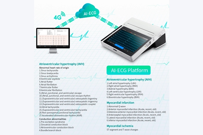 Grade 18 Leads Smart Portable ECG Monitor T180 with Printer AI Analysis Diagnosis Tablet Touch Screen