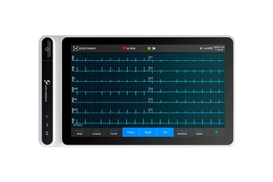 Tablet ECG Machine S120 Smart Portable 12-Lead Cardiac Monitor with Bluetooth Printer Artificial Intelligence Analysis Diagnosis and Touch Screen