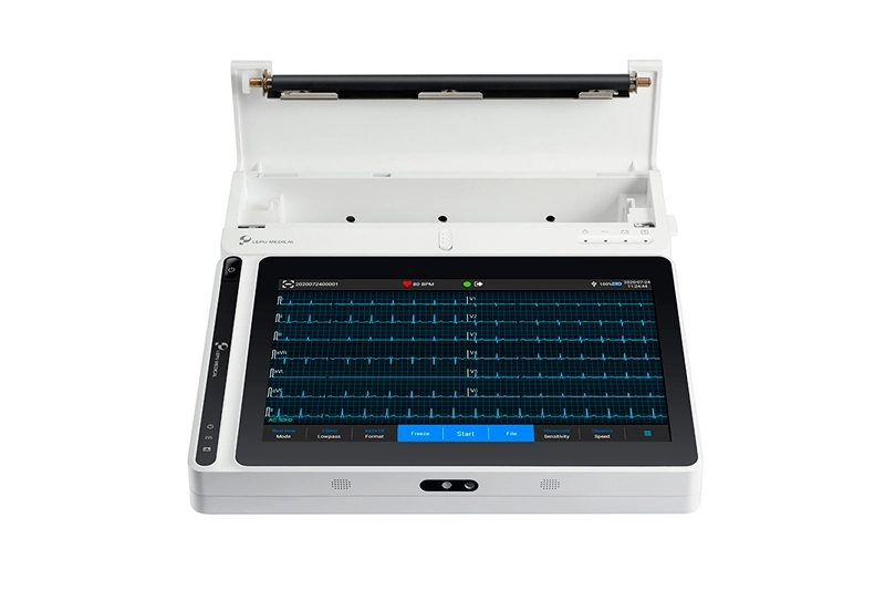 Grade 18 Leads Smart Portable ECG Monitor T180 with Printer AI Analysis Diagnosis Tablet Touch Screen
